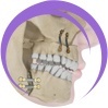 تصحيح عاهات الوجه