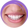 إعادة تصميم كاملة للابتسامة